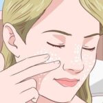 MỤN ẨN Ở MÁ: Nguyên nhân | Cách trị mụn ẩn trên má Tận Gốc