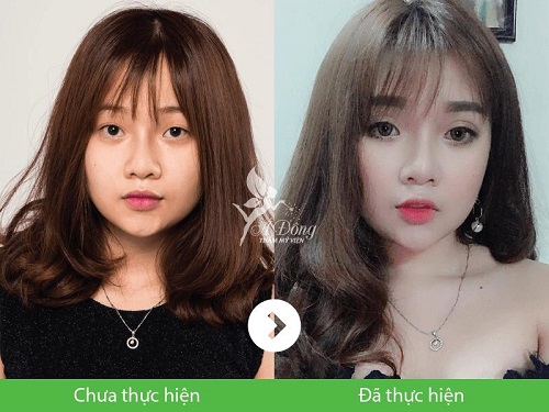 thẩm mỹ á đông