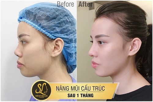 thẩm mỹ sline