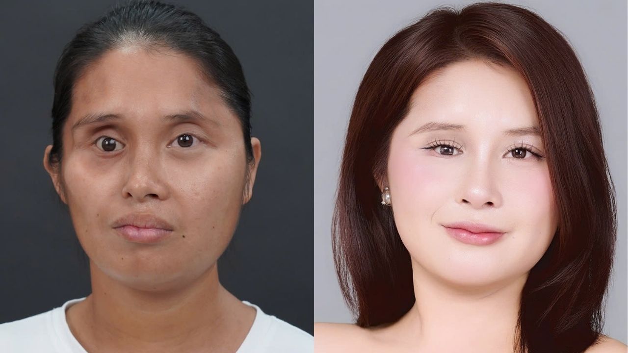 Đột biến NST “ziczac” có phẫu thuật thẩm mỹ được không? Câu chuyện Lê Thị Yến Hành Trình Lột Xác